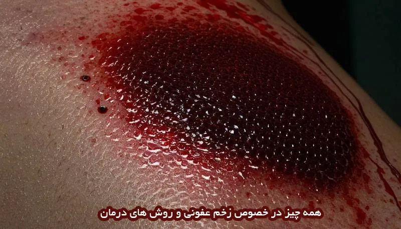 همه-چیز-در-خصوص-زخم-عفونی
