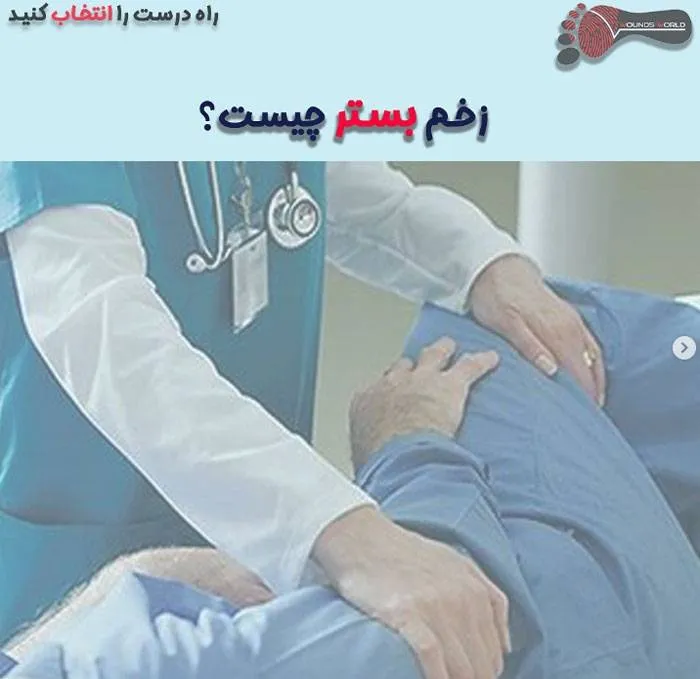 درمان زخم-بستر