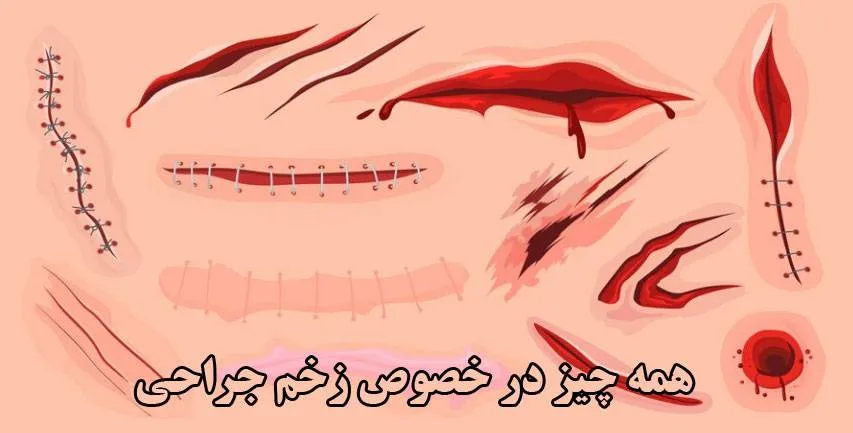 زخم-جراحی
