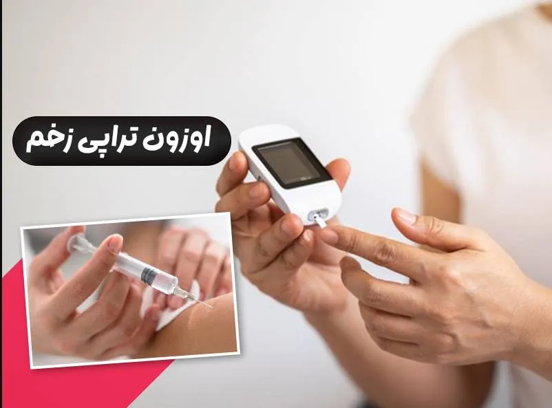 ازن-تراپی-زخم