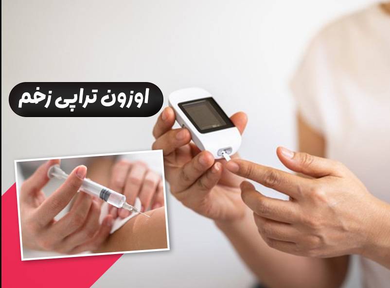 ازن-تراپی-زخم