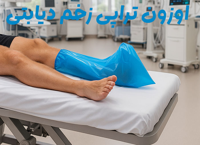 اوزون-تراپی-زخم-دیابتی