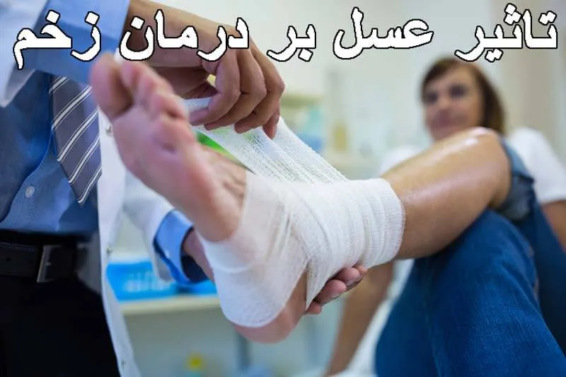 تاثیر عسل در ترمیم پذیری بستر زخم