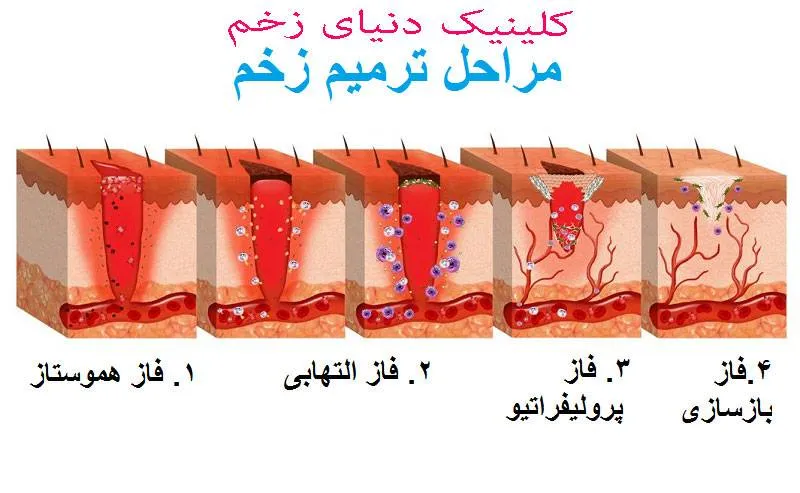 فازهای التیام زخم