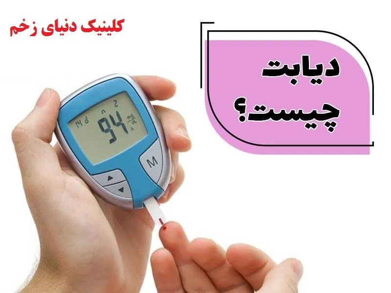 دیابت