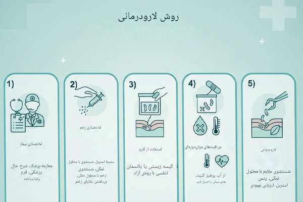 روش ماگوت تراپی
