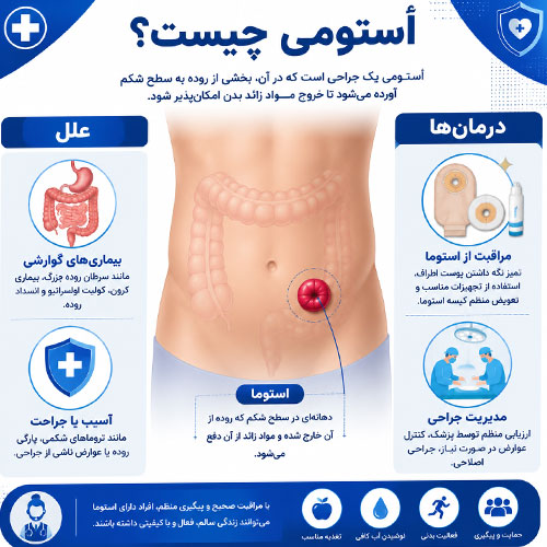 ostomy استومی
