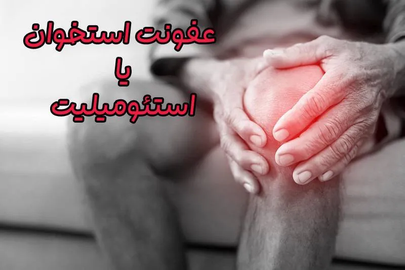 استئومیلیت