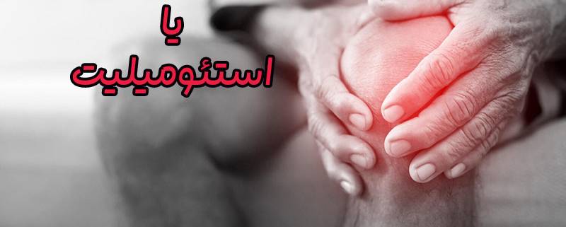 استئومیلیت