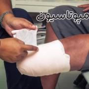 آمپوتاسیون