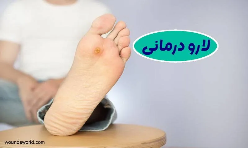 لارو درمانی
