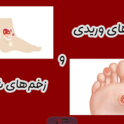 زخم های وریدی و شریانی