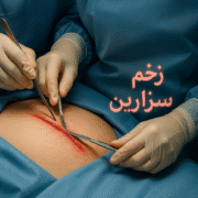 زخم سزارین