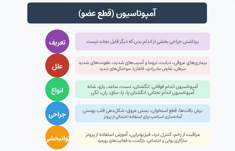 آمپوتاسیون