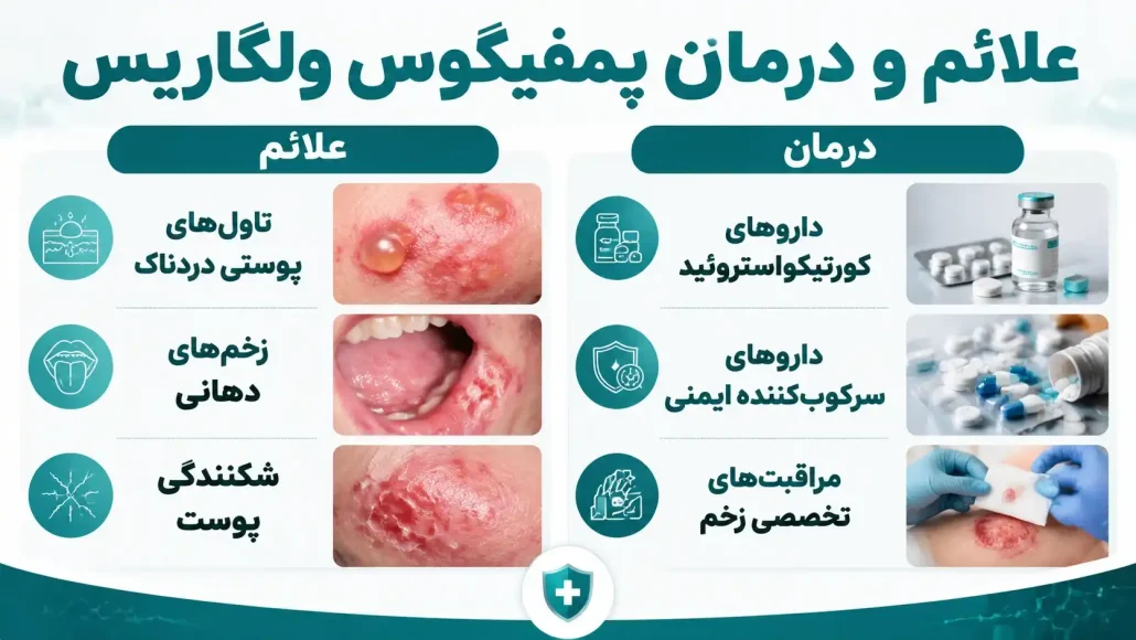 e90ac2c2-c9c3-4465-b874-eb2c96dd3f7f_11zon درمان پمفیگوس ولگاریس
