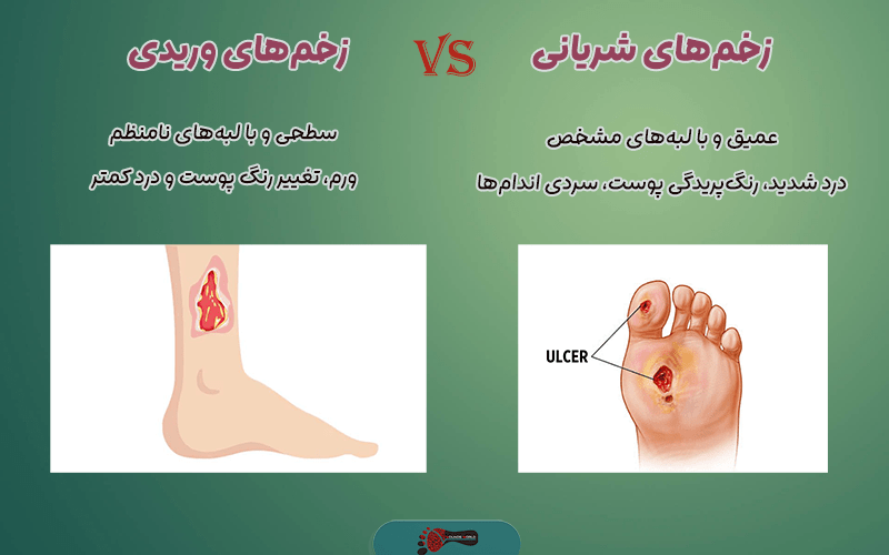 زخم های وریدی و شریانی