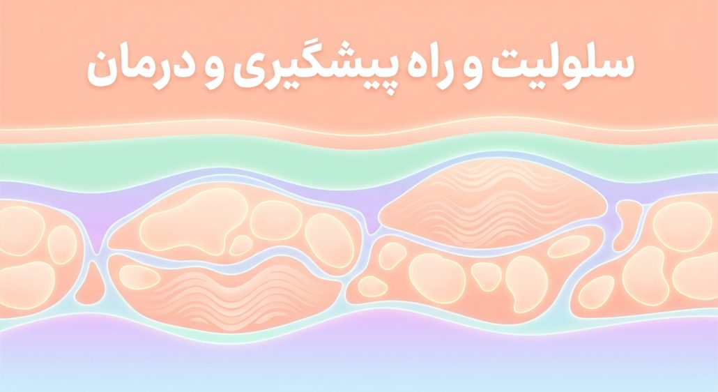 سلولیت
