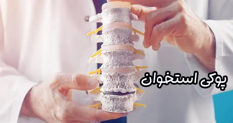 پوکی استخوان