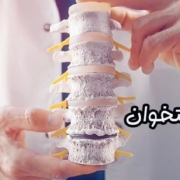 پوکی استخوان
