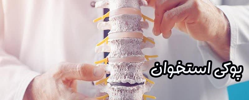 پوکی استخوان