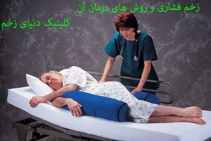 درمان زخم بستر