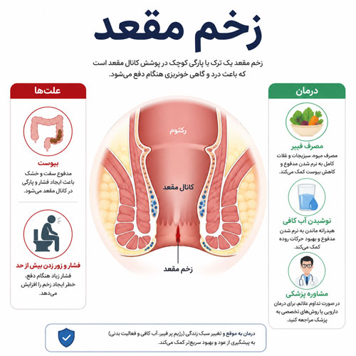 زخم مقعد