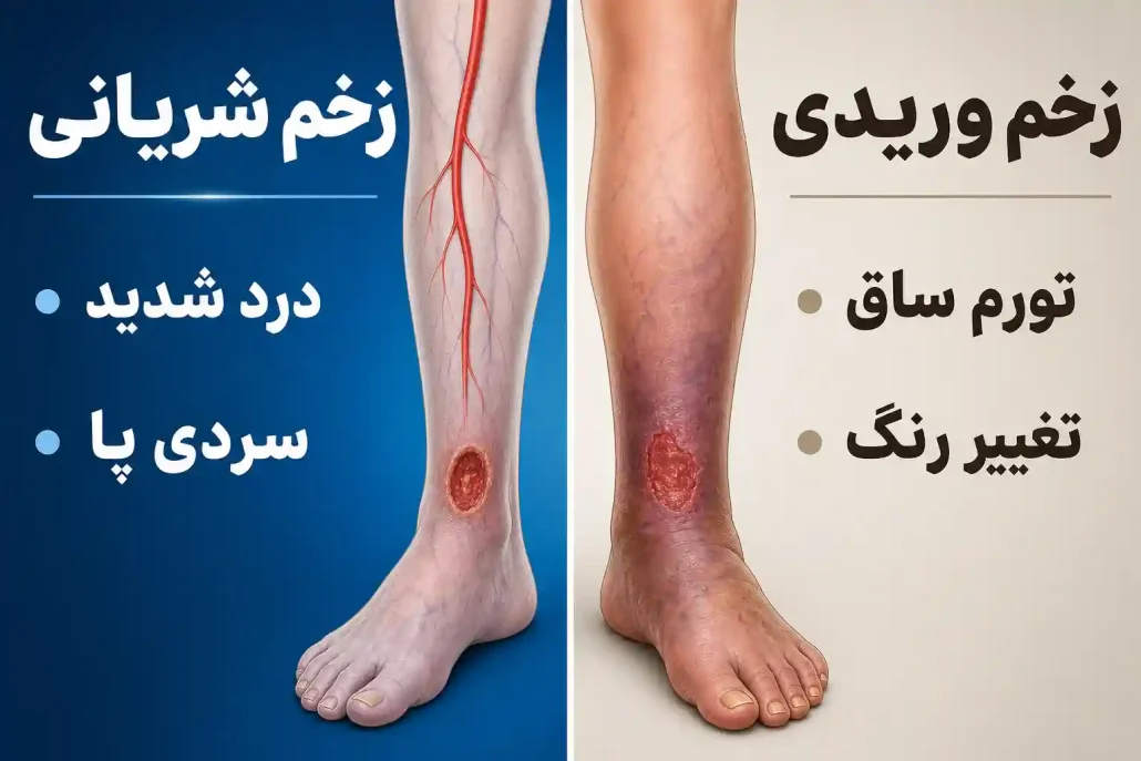 زخم های وریدی و شریانی چه تفاوت هایی با هم دارند؟