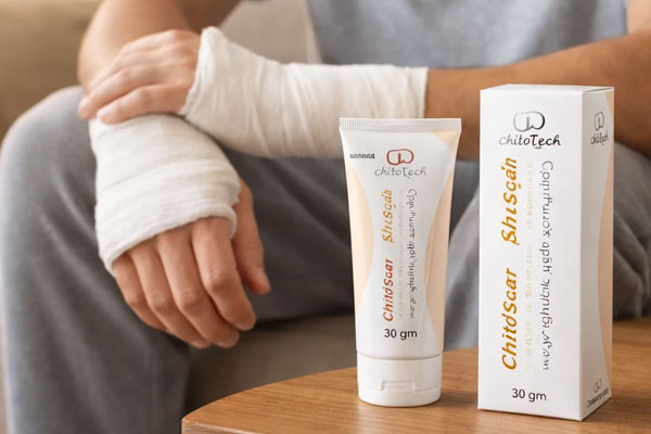 ژل-برطرف-کننده-اسکار-کیتواسکار