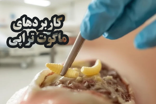 ماگوت تراپی