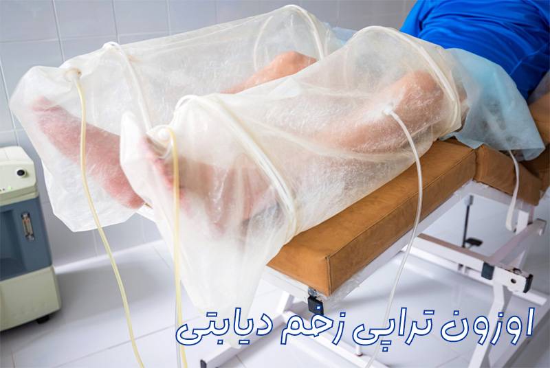 اوزون تراپی پا