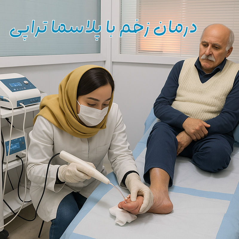 پلاسما-ترای-نوین