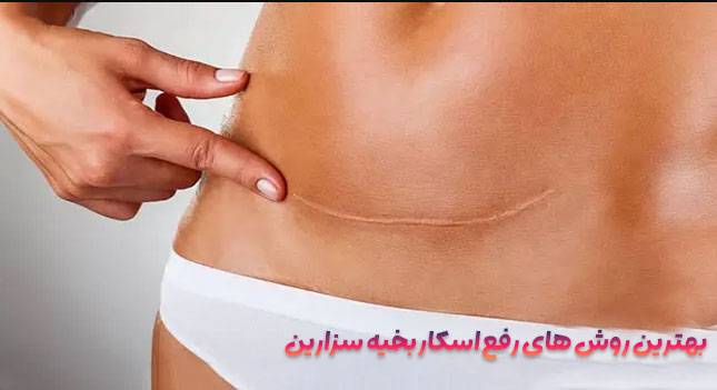 از بین بردن جای زخم