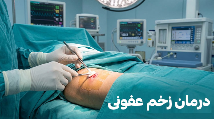 درمان-زخم-عفونی