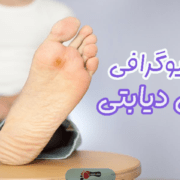 آنژیوگرافی پای دیابتی