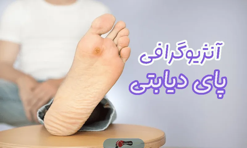 آنژیوگرافی پای دیابتی