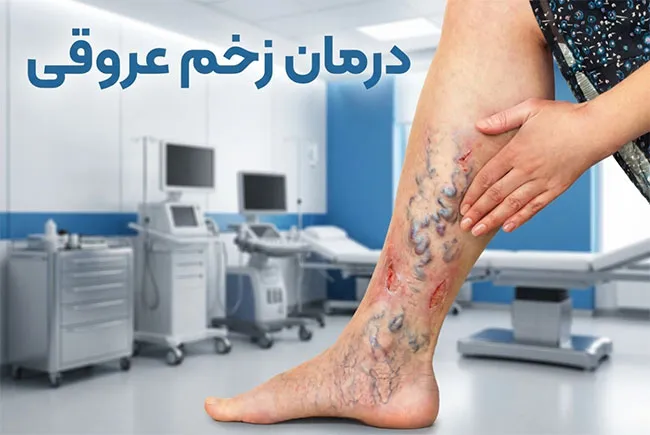زخم-شریانی