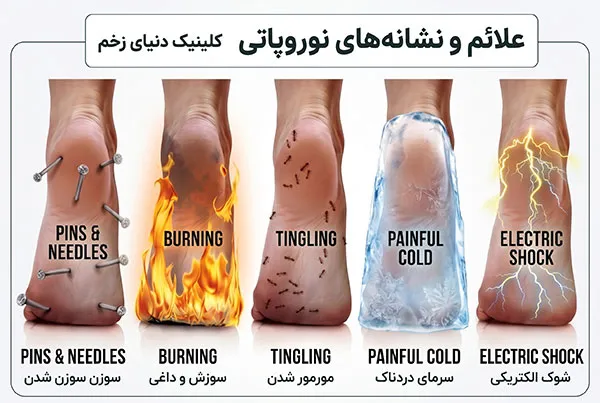 نوروپاتی دیابتی چطور شکل میگیرد