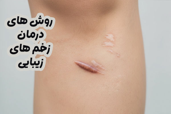 درمان زخم زیبایی