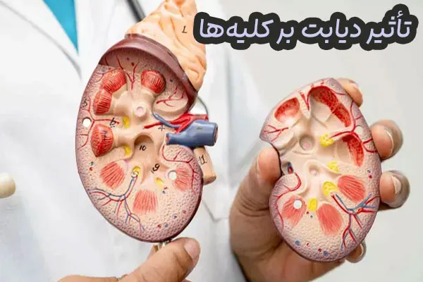 تأثیر دیابت بر کلیه‌ها