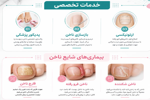;gdkd; کلینیک ناخن