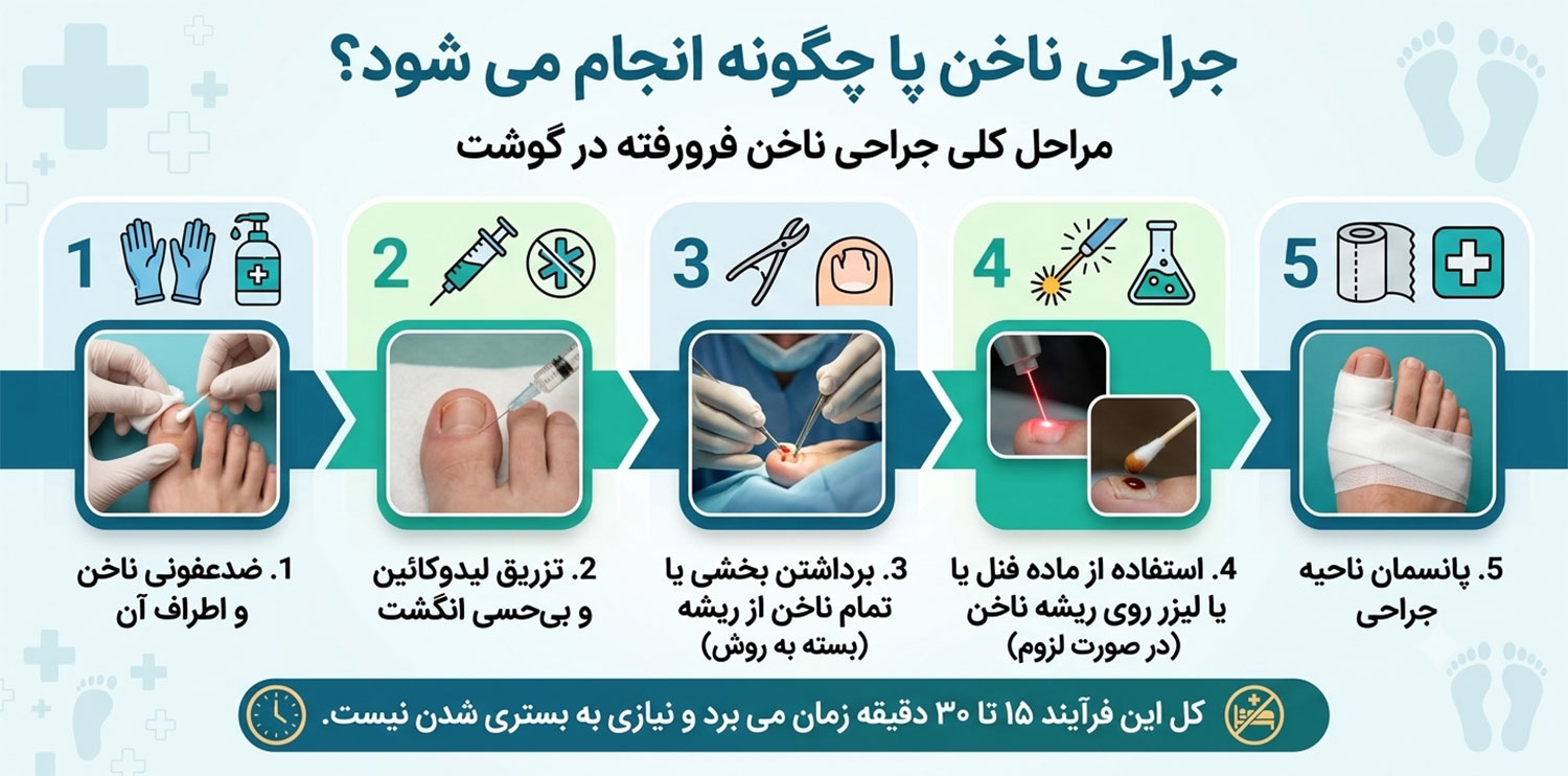 جراحی-ناخن-پا
