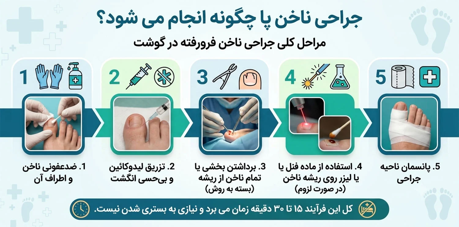 جراحی-ناخن-پا