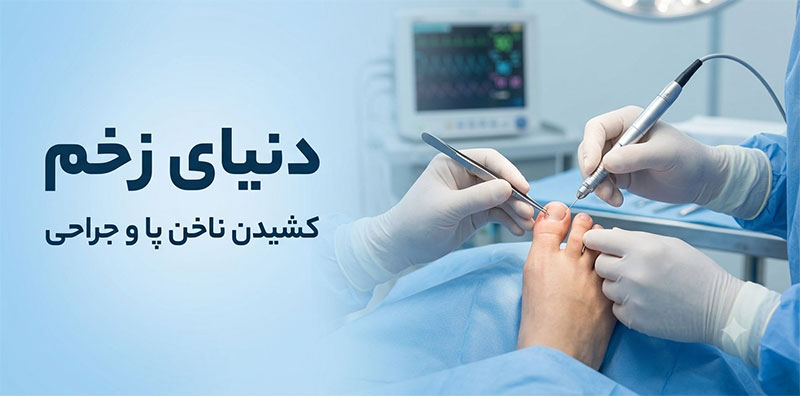 کشیدن-ناخن-پا