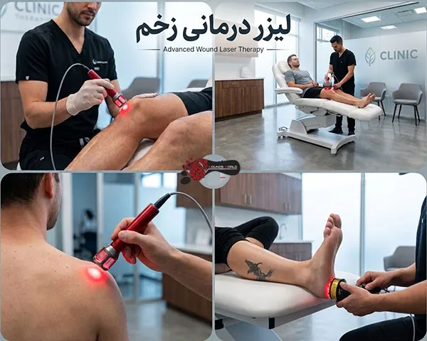 لیزر تراپی زخم