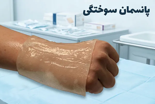 پانسمان نوین-سوختگی