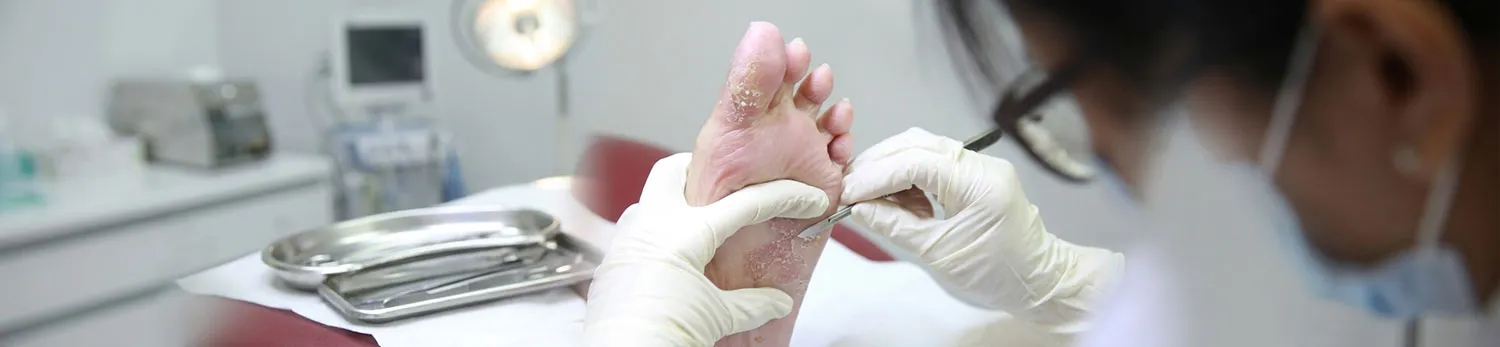 دبریدمان شارپ زخم - Sharp Debridement